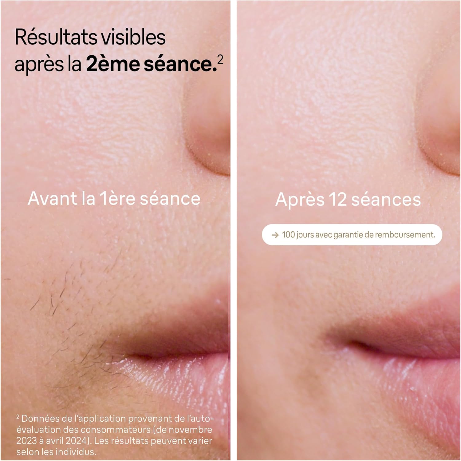 Thumbnail 2 de Braun Silk·expert Pro 5 épilation 2 séances 🪒