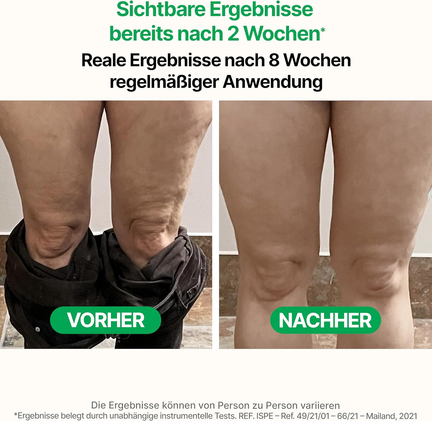 Detalle 2 de TESMED CELLULITE Massage-Roller 9–38 cm