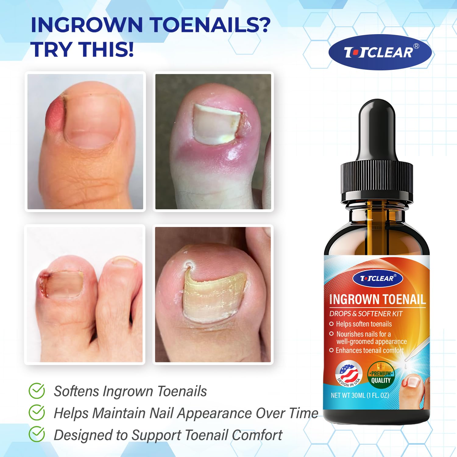 Detalle de Ingrown Toenail Relief: 30ml Kit with Drops for Gentle Care