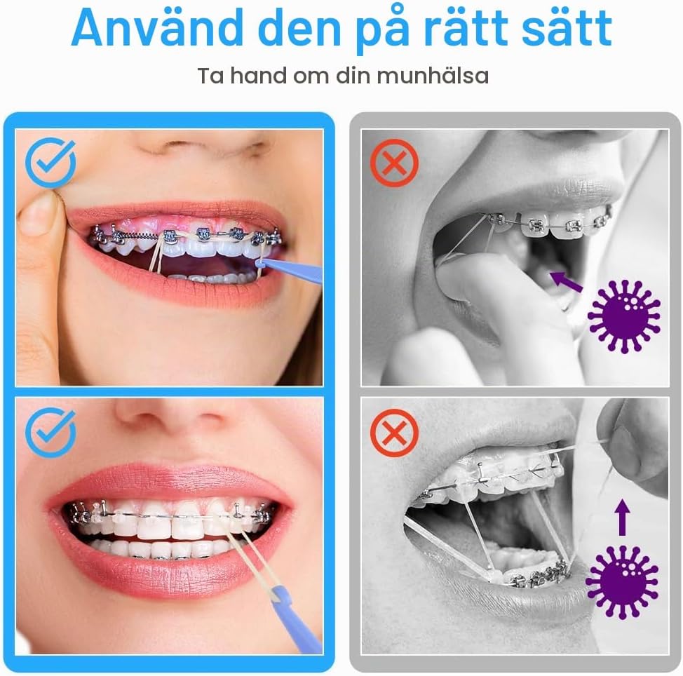 Detalle 1 de OFFCUP ortodontiska gummiband 5/16, 500-pack med 5 placeringsverktyg