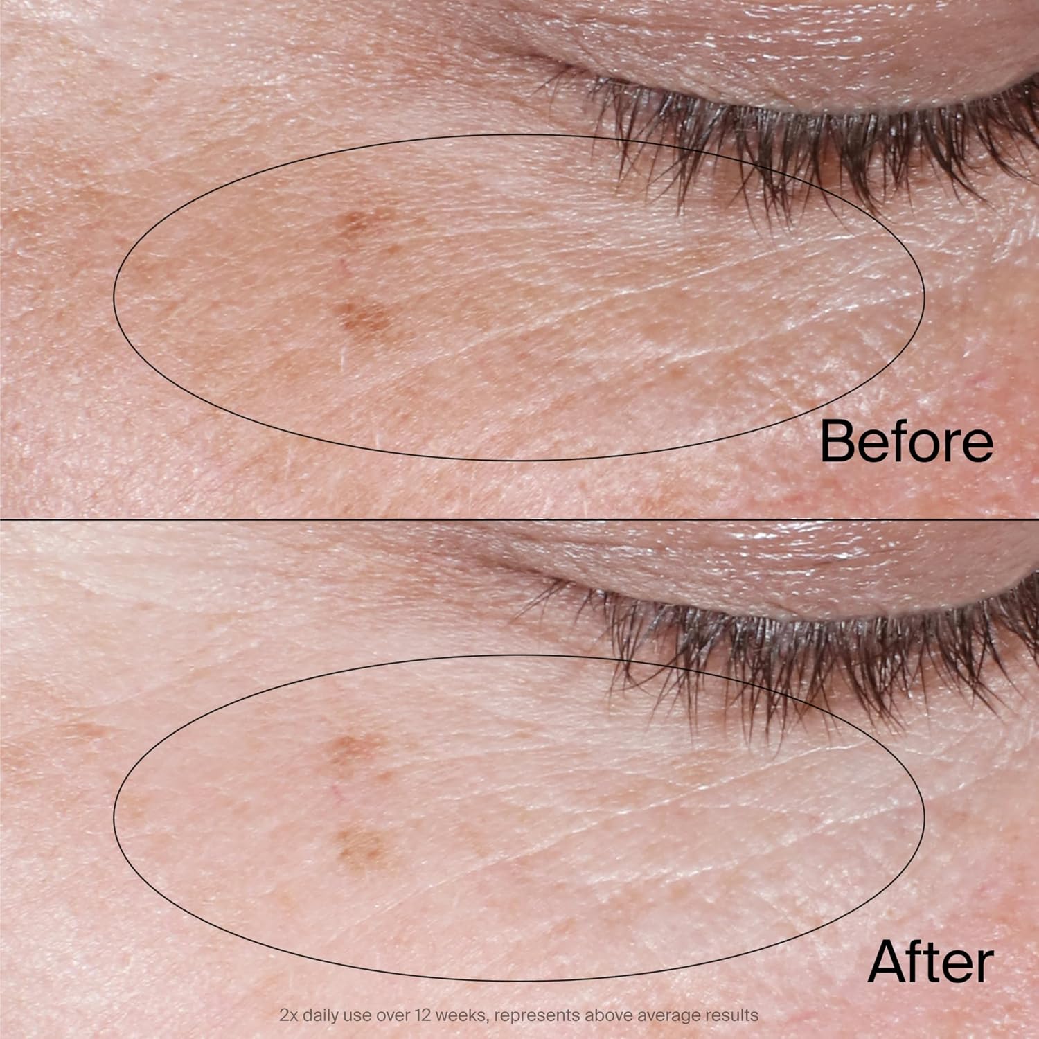Thumbnail 5 de Neutrogena Collagen Bank 0.5oz Under-Eye Cream