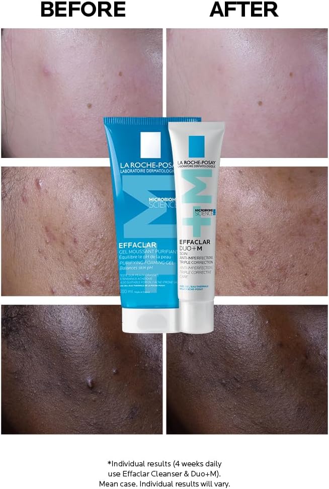 Detalle 2 de La Roche-Posay Effaclar Duo+ 40ml Anti-Breakout Gel