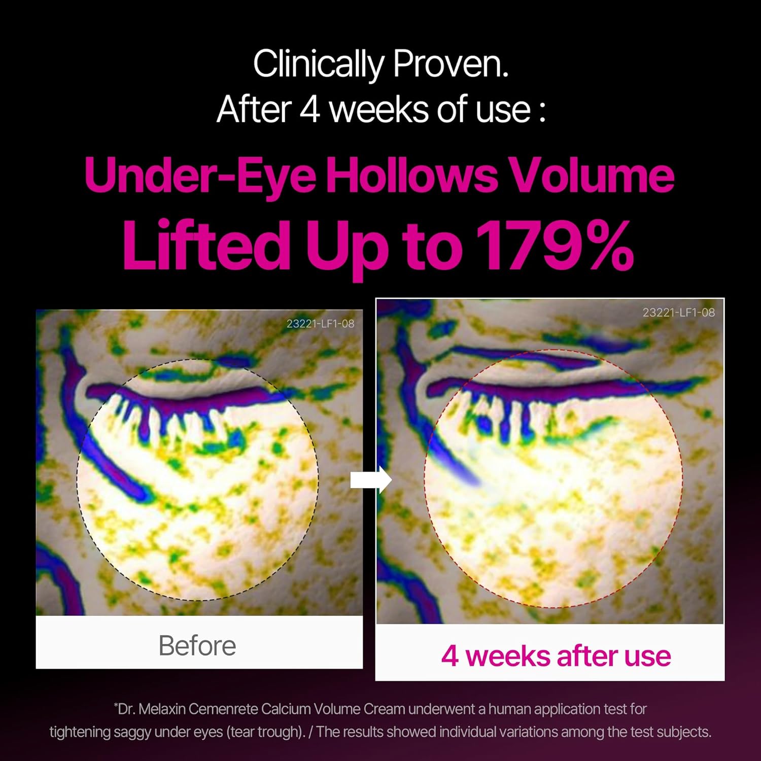 Thumbnail 1 de Dr.Melaxin Calcium Intense Firming Cream with Collagen & Elastin (1.69 fl. oz) — lifting & plumping face cream