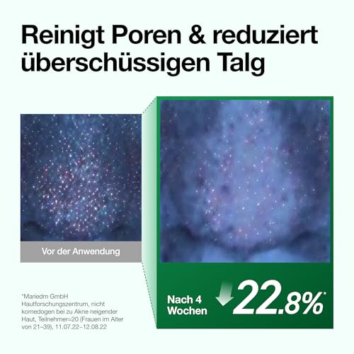 Detalle de ANUA Heartleaf Pore Cleansing Oil 200 ml – sanfte Double-Cleanse für alle Hauttypen