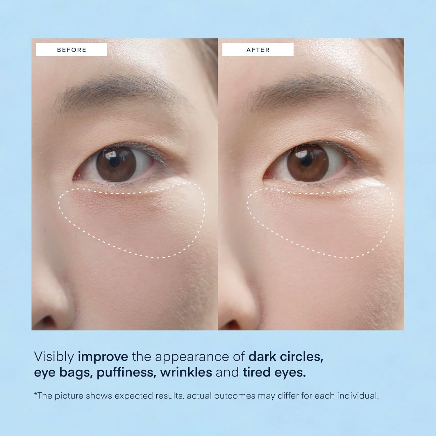 Thumbnail 3 de TEREZ & HONOR Under Eye Patches with Caffeine, Hyaluronic Acid, Niacinamide – 60 Hydrogel Masks ⚡