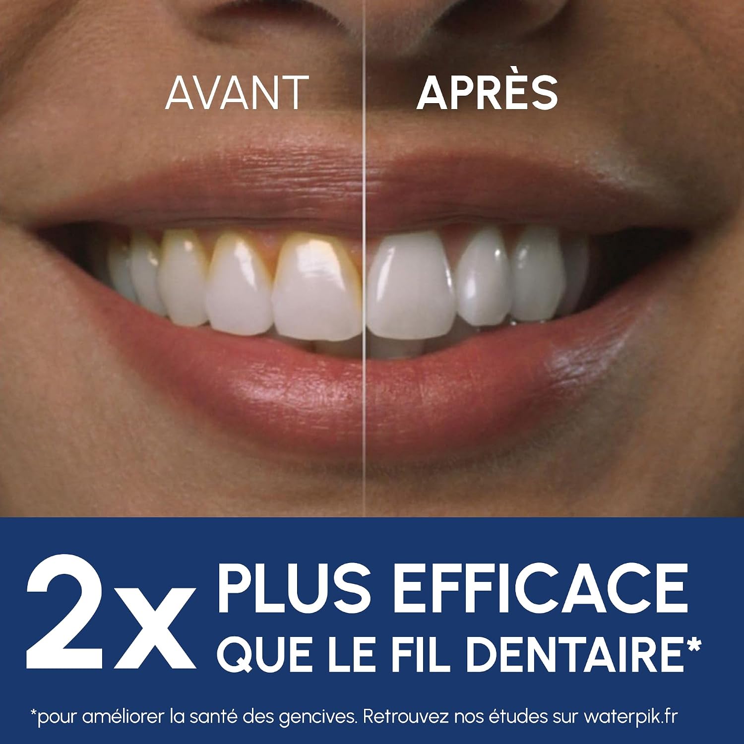 Detalle de Waterpik WF-27 Pearl hydropulseur 60 secondes