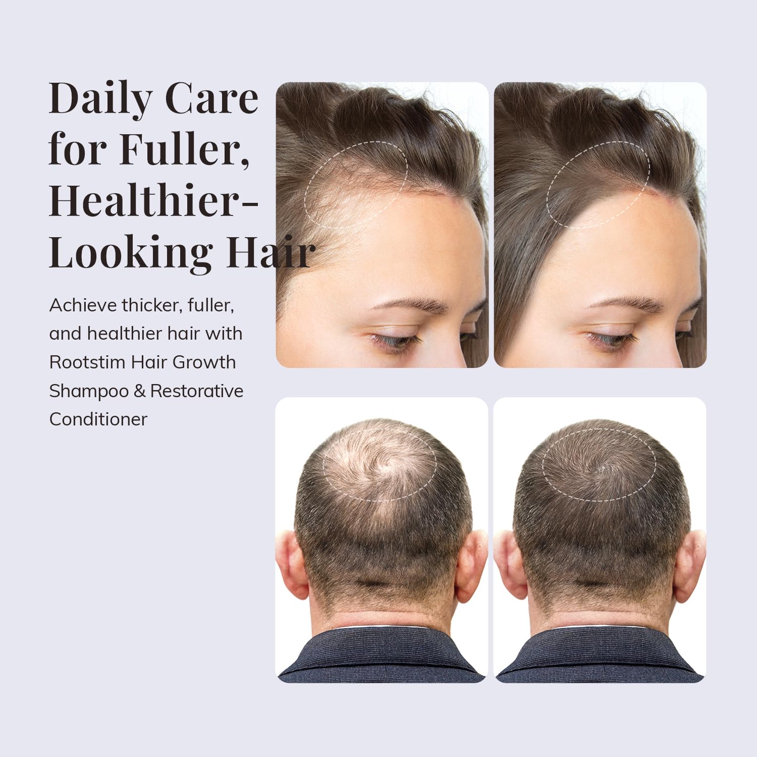 Thumbnail 3 de RootStim Hair Growth Shampoo Set 2-Pack