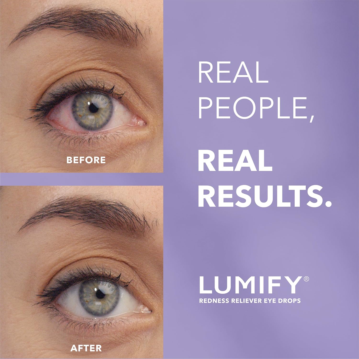 Detalle de LUMIFY Eye Drops for Red Eyes – Brimonidine Redness Reliever (0.25 Fl Oz / 7.5 mL)
