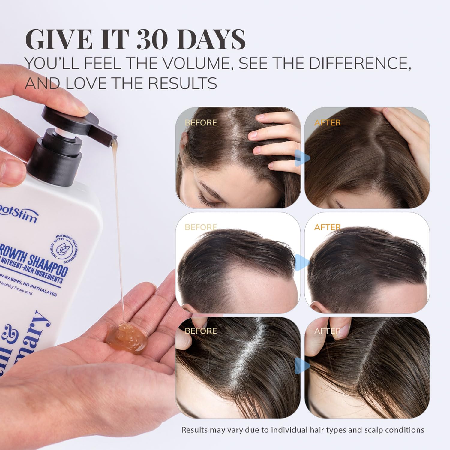 Thumbnail 4 de RootStim Biotin & Rosemary Shampoo for Hair Growth 10 oz
