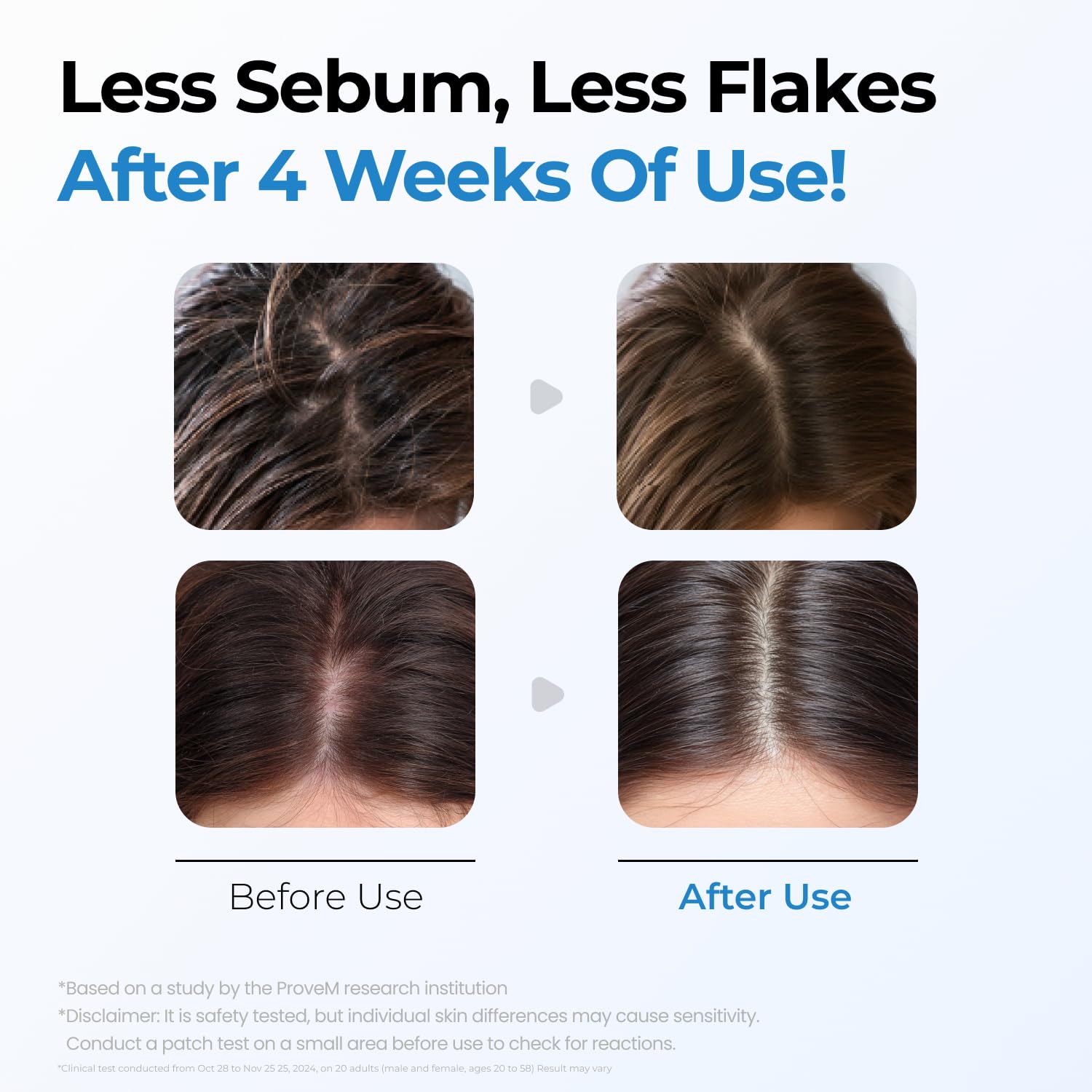 Detalle 1 de Seapuri Scalpy Bubble Tonic for scalp care