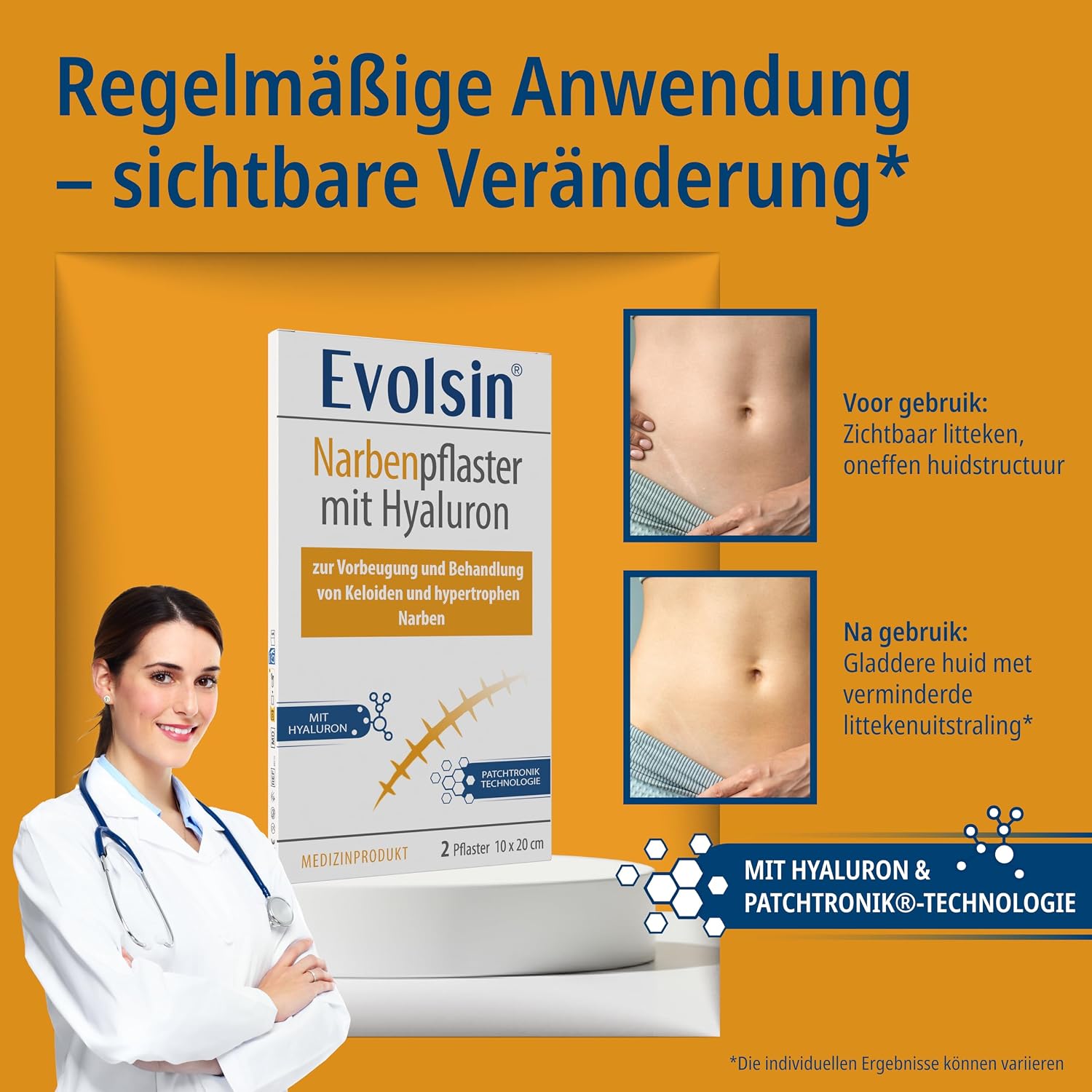 Detalle 2 de Evolsin Narbenpflaster mit Hyaluron & Patchtronik – Für OP-Narben, Kaiserschnitt, Keloide & hypertrophe Narben