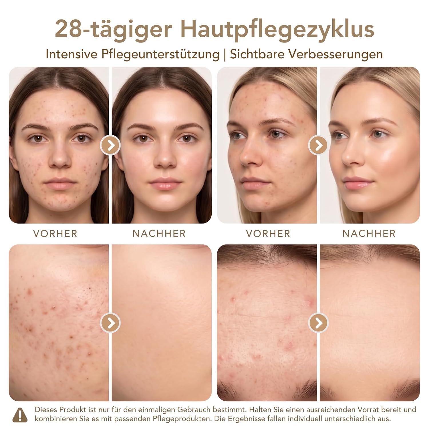 Detalle de Dr.pen Ultima M9 2026 kabellos Microneedling – Tiefeneinstellung 0–2,5 mm, LED-Display, 700 mAh Akku