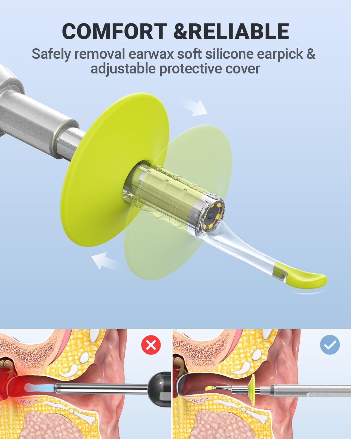 Detalle de AnyScope Digital Otoscope for iPhone & Android, 3.9 mm Camera, 6 LEDs