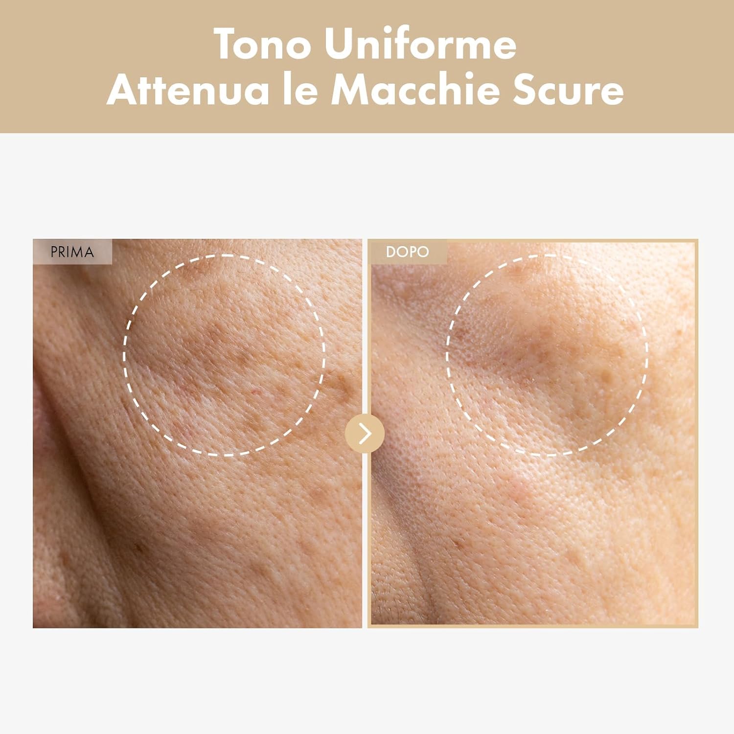 Thumbnail 1 de TOSOWOONG Tonico lattiginoso illuminante al riso con niacinamide, ceramidi e pantenolo (250 ml)
