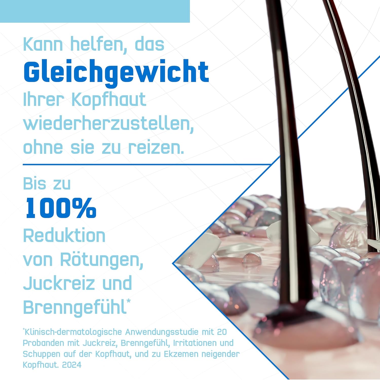 Thumbnail 2 de Terzolin Expert Schuppen-Shampoo für trockene Kopfhaut bei Juckreiz & Schuppen (200 ml)