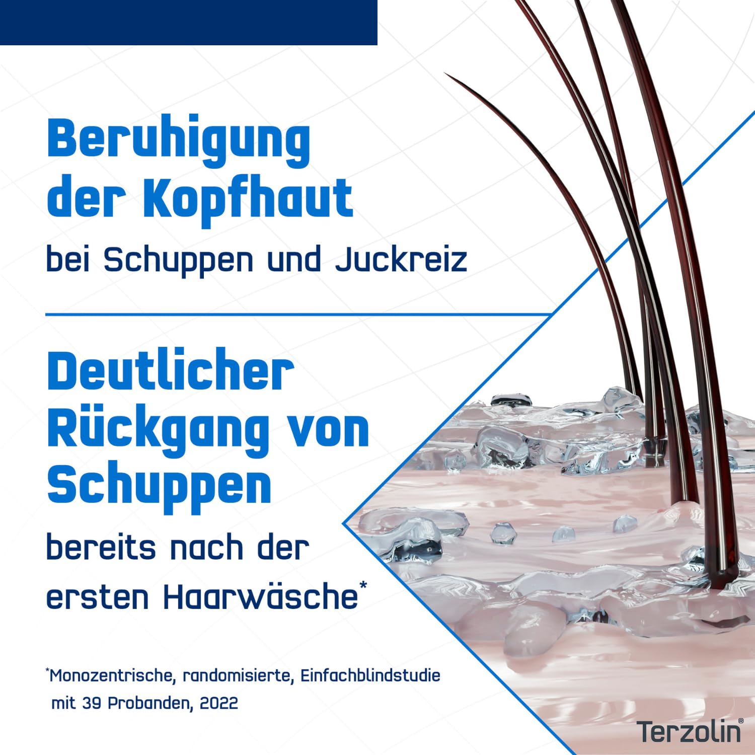 Detalle de Terzolin® Expert Schuppen-Shampoo für fettige Kopfhaut mit Juckreiz & Schuppen – 200 ml