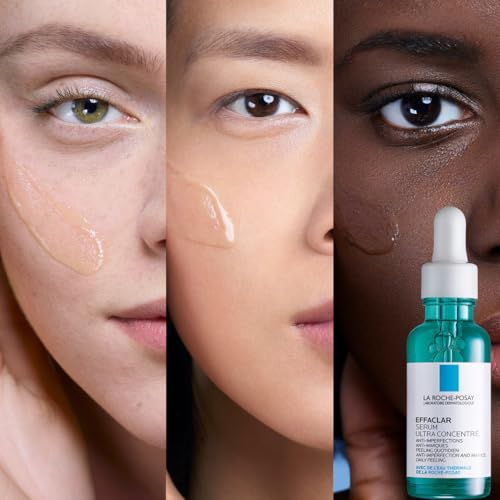 Thumbnail 8 de La Roche-Posay Effaclar Siero Peeling Ultra-Concentrato Levigata 30 ml – recensione e guida all’uso