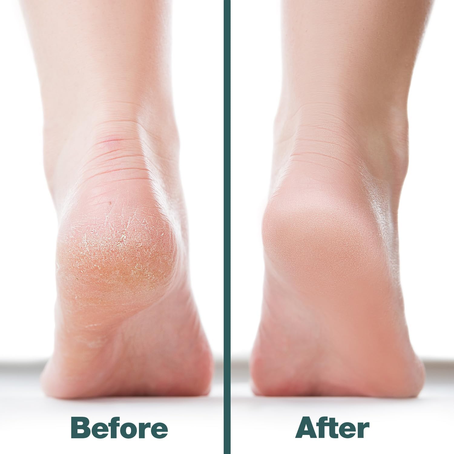 Thumbnail 4 de Probelle Double Sided Foot File