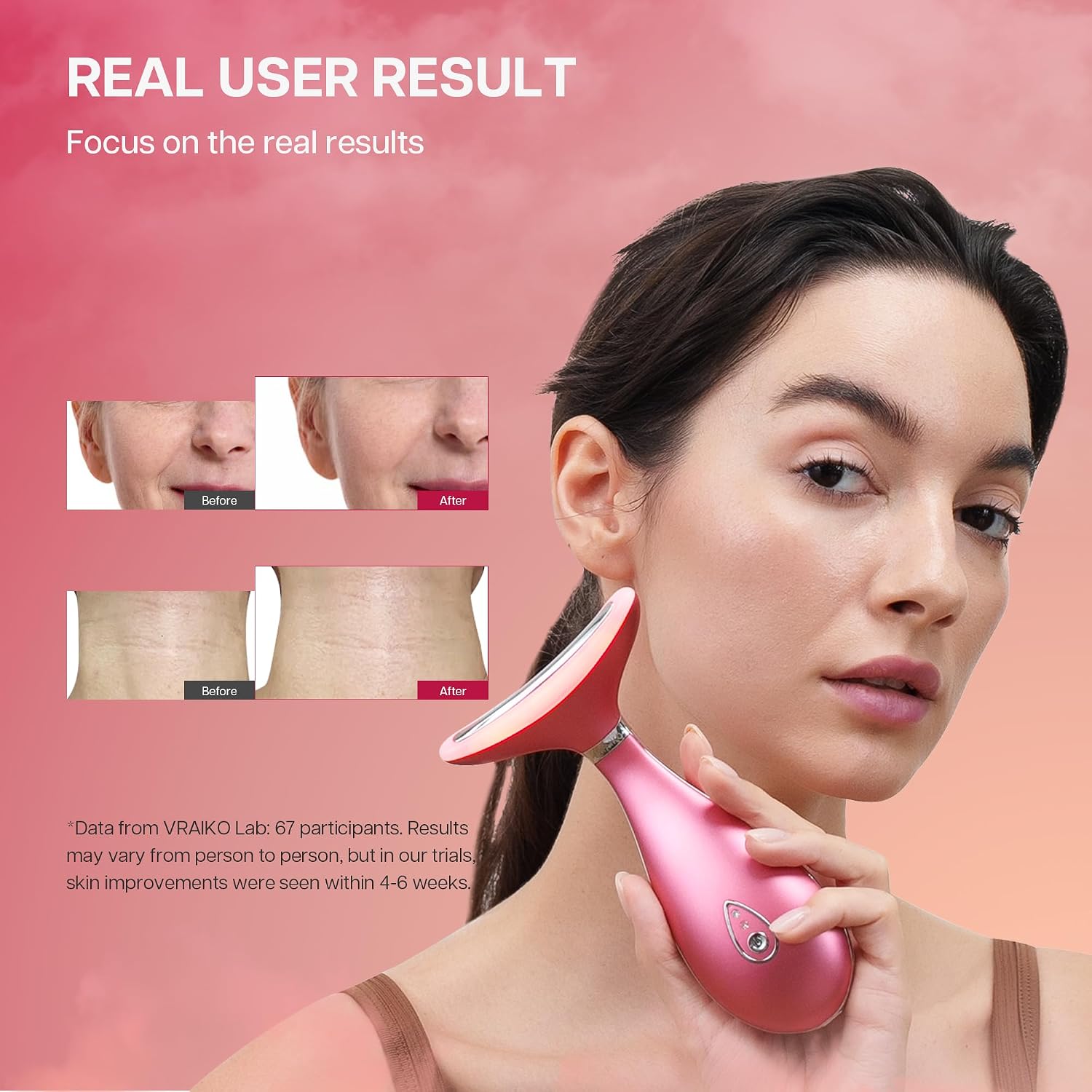 Detalle 2 de VRAIKO LILY Massaggiatore viso-collo: triple azione LED termico per sollevamento e rassodamento, Rosa intenso