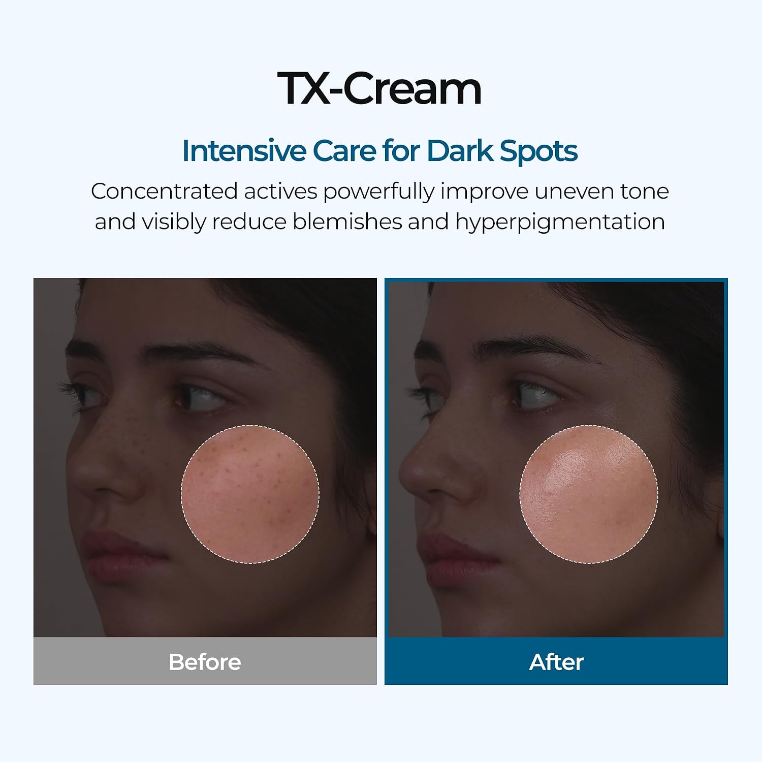 Thumbnail 1 de DR.Melaxin TX Tranexamic Cream 50 ml