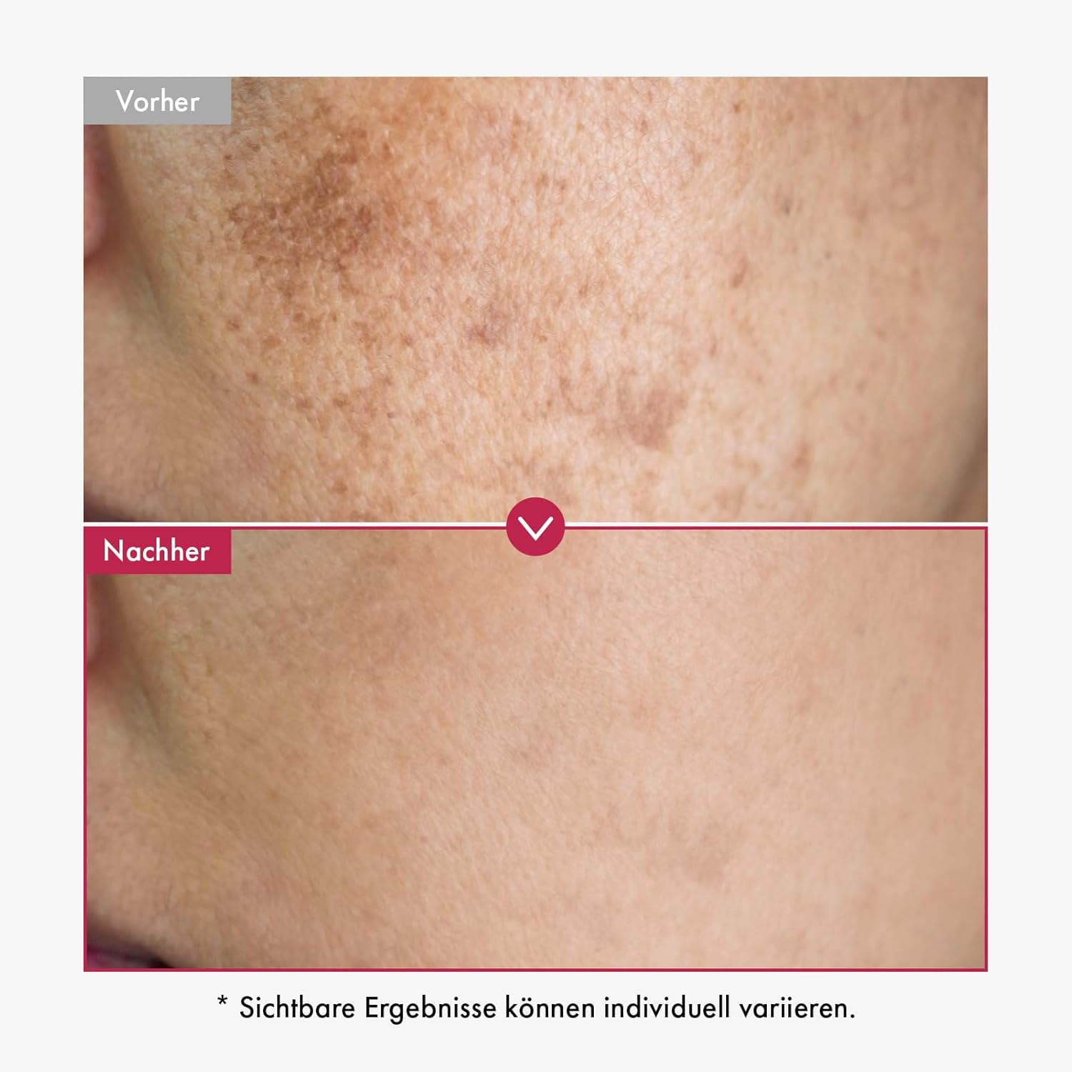 Thumbnail 2 de TOSOWOONG Niacinamid 10% Serum 33 ml