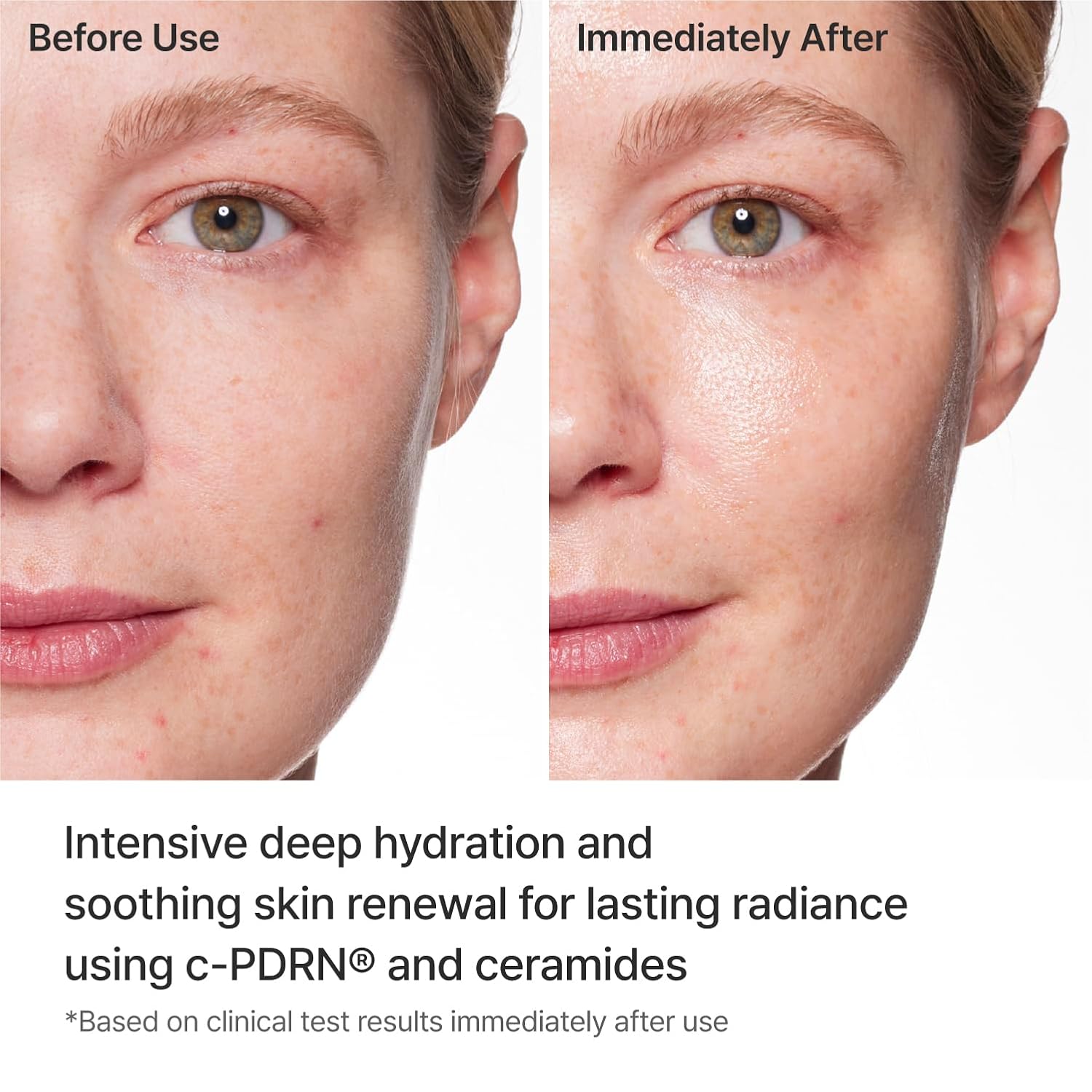 Thumbnail 3 de REJURAN Turnover Mask with c-PDRN (5ea) — Ultra Microfiber Sheet Mask for Firming, Hydration, Repair & Revitalization