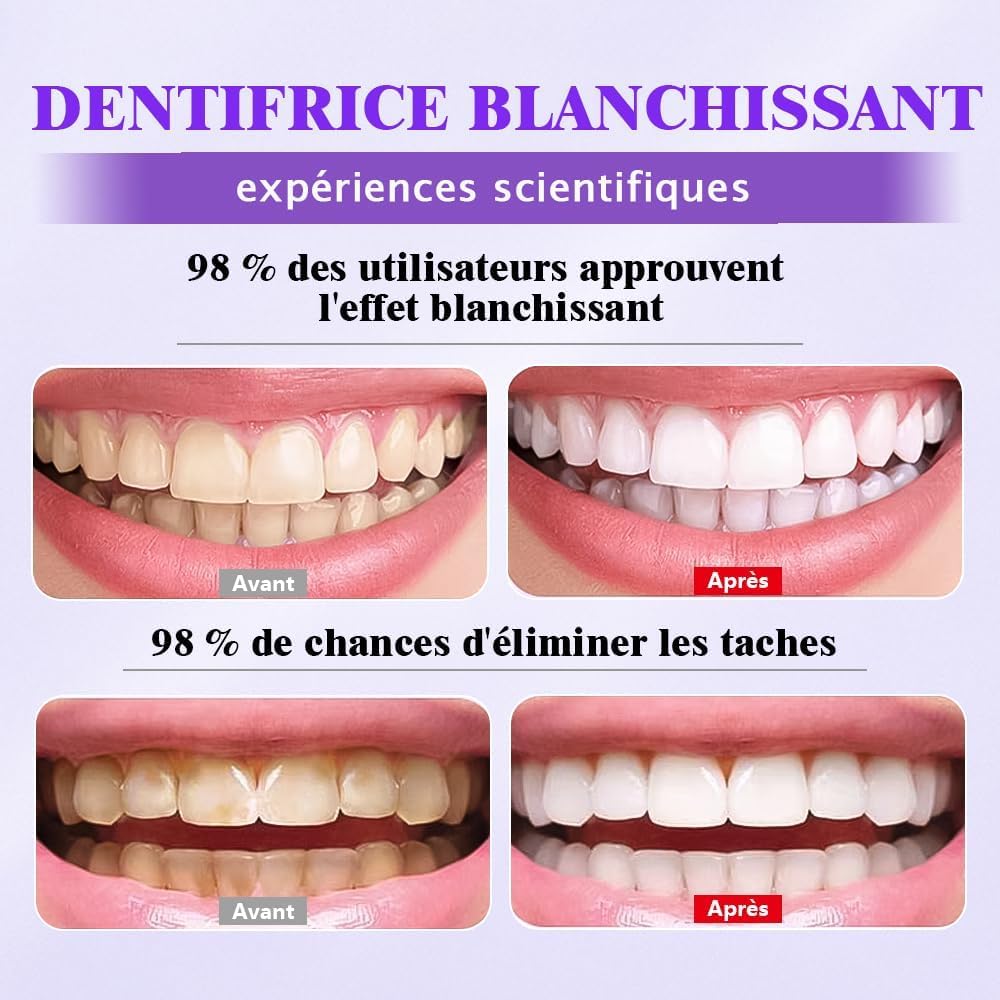 Detalle de Blanchiment Dentaire Professionnel en Poudre – Taches Café/Thé/Vin, Sourire Éclatant et Haleine Fraîche