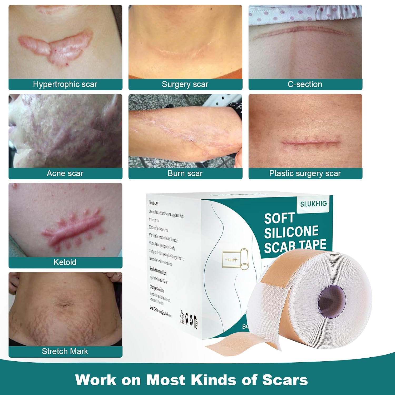 Detalle 2 de Silicone Scar Sheets 1.6" x 158" Roll