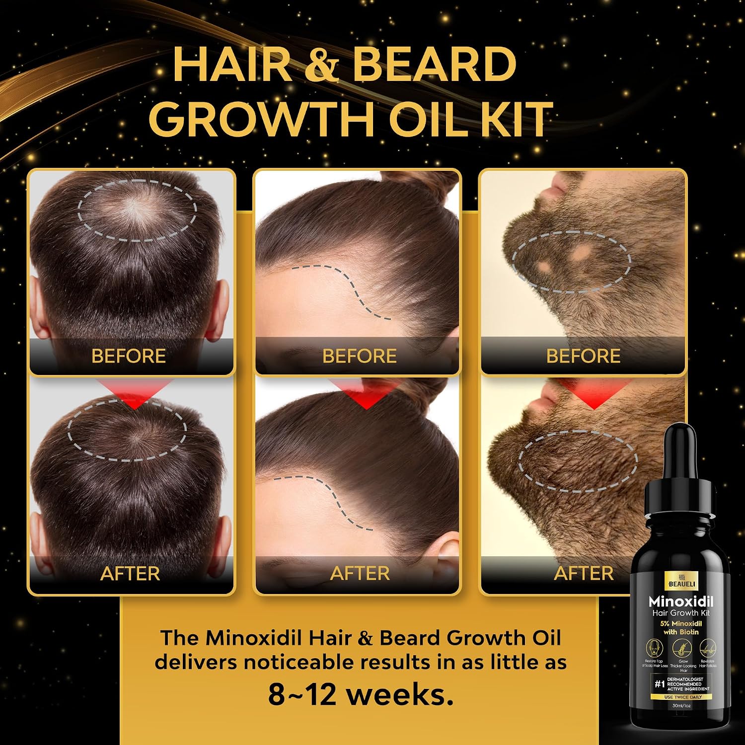 Thumbnail 1 de Beaueli 5% Minoxidil Beard Growth Kit with Biotin, Black