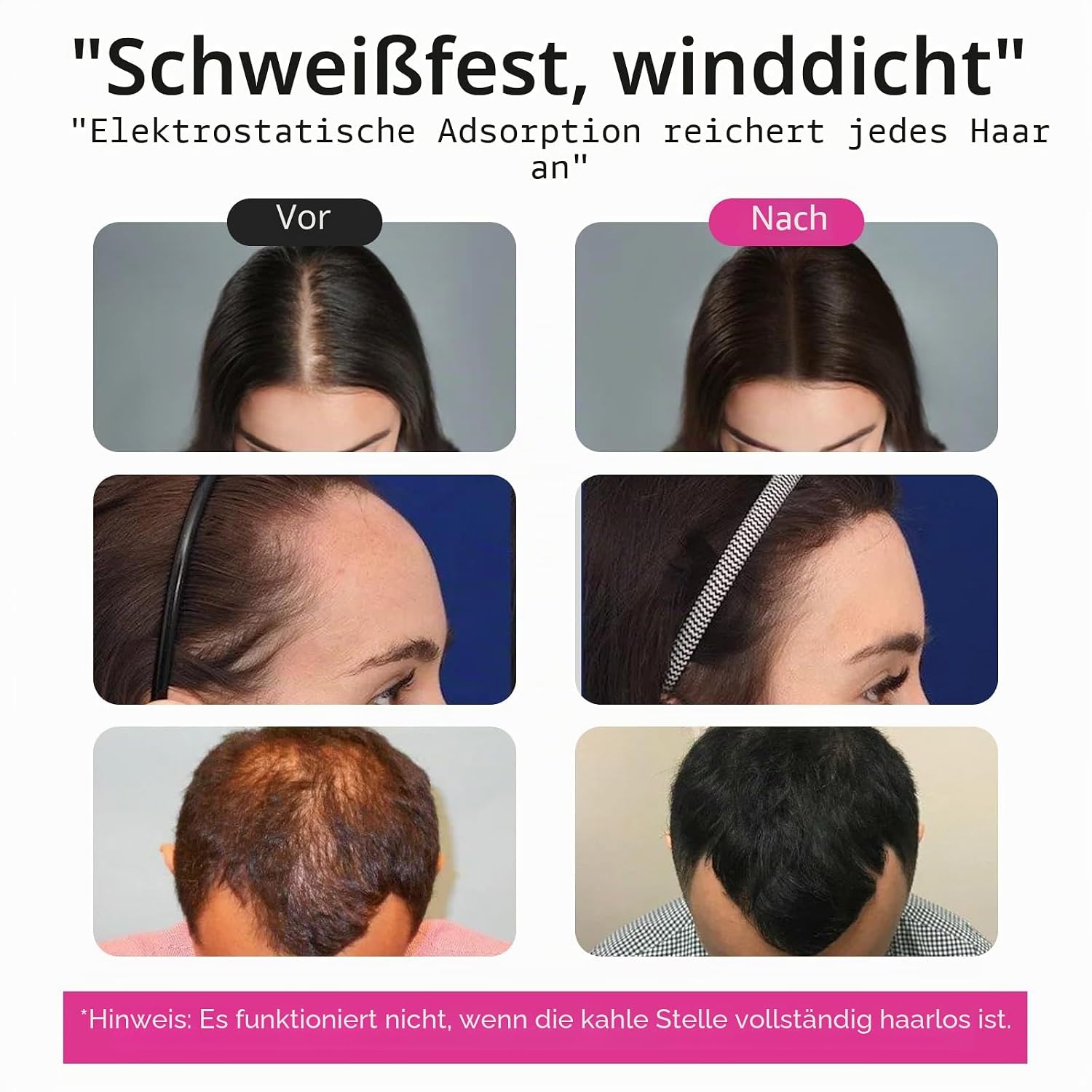 Thumbnail 5 de Haarfasern für Haaraufbau, 100 g dunkelbraun