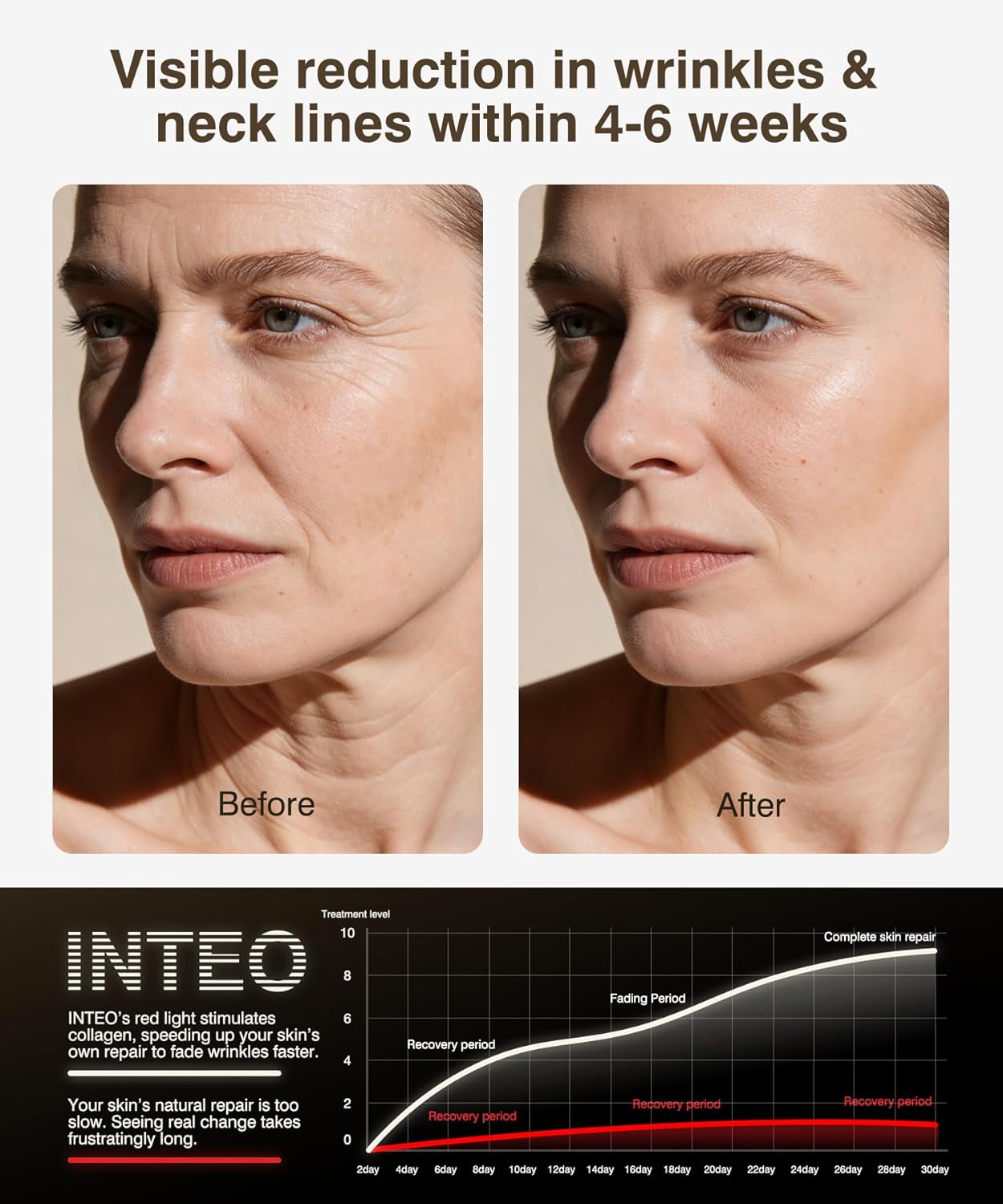 Detalle de Red Light Therapy for Face and Neck: 4 Modes Cordless Mask with 680 Beads