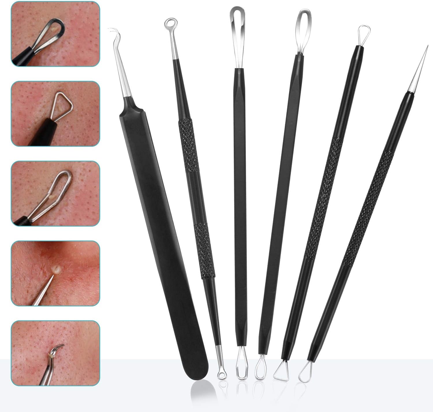 Detalle 2 de Blackhead Remover Pimple Popper Tool Kit 6 Piece