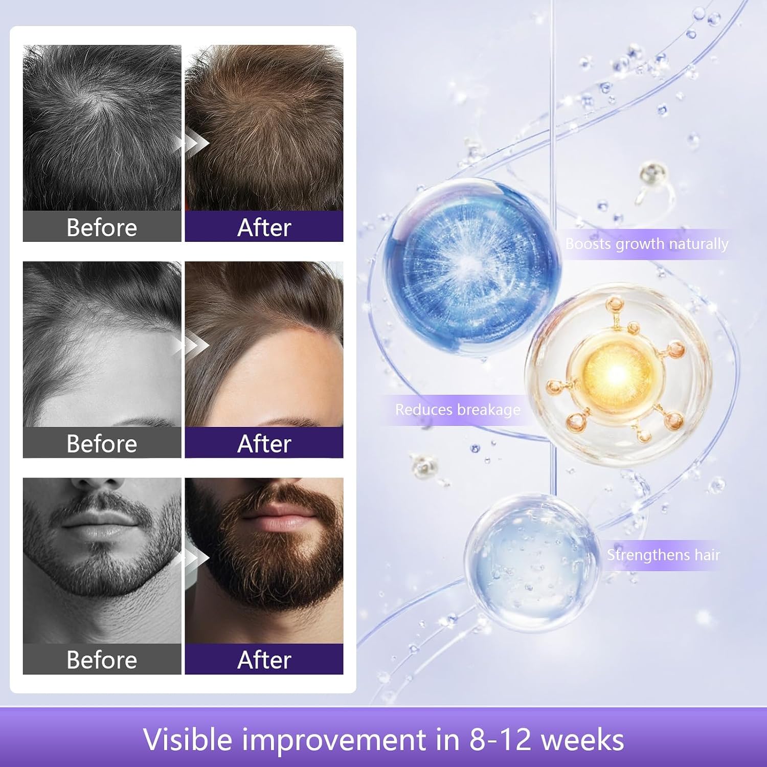Detalle 2 de Hair Growth Spray Serum mit Rosmarinöl – 60 ml für Haarwachstum, Anti-Haarausfall (Männer & Frauen)