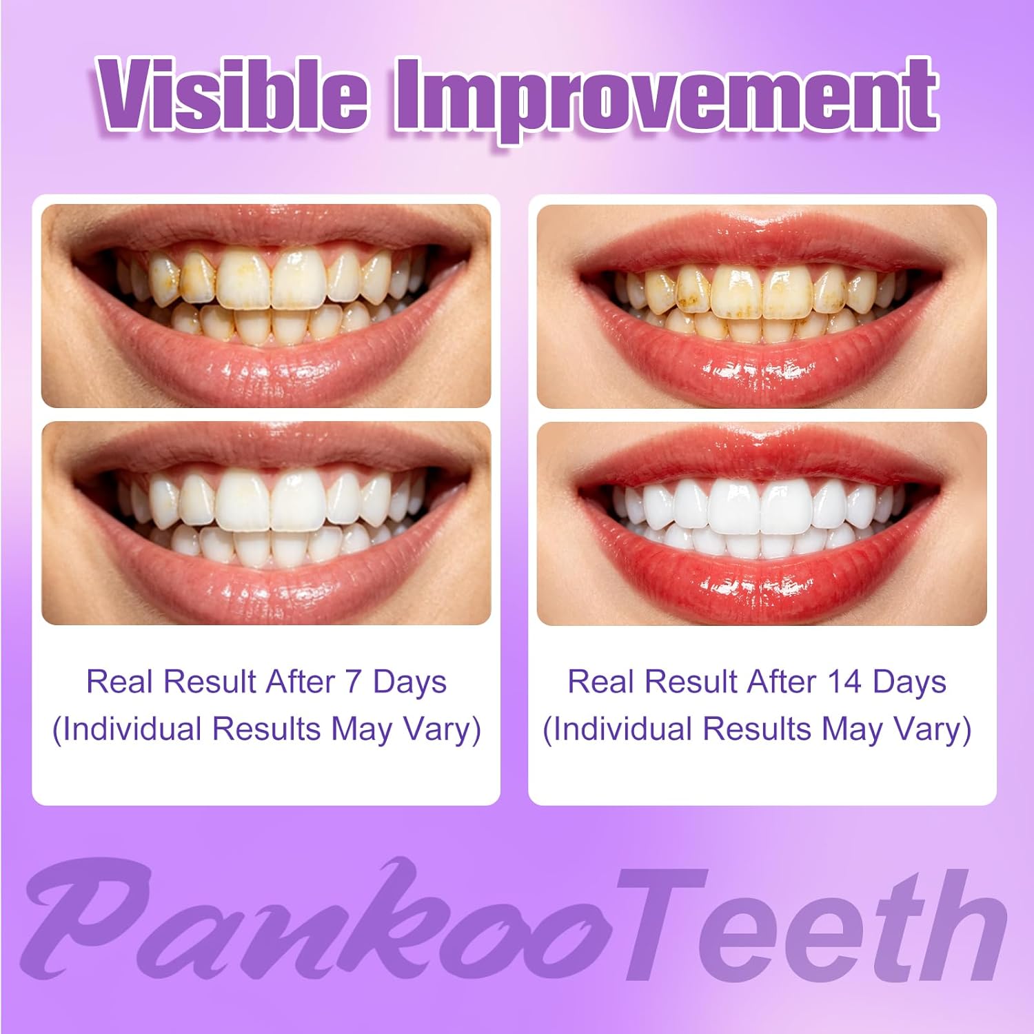 Detalle de PankooTeeth Purple Teeth Whitening Strips – 21 Treatments (42 Strips)