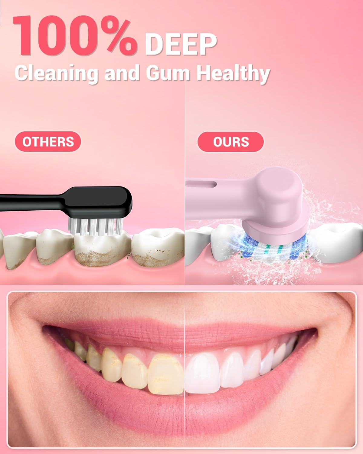 Detalle 1 de YTEATH PRO Rotating Toothbrush 60 day