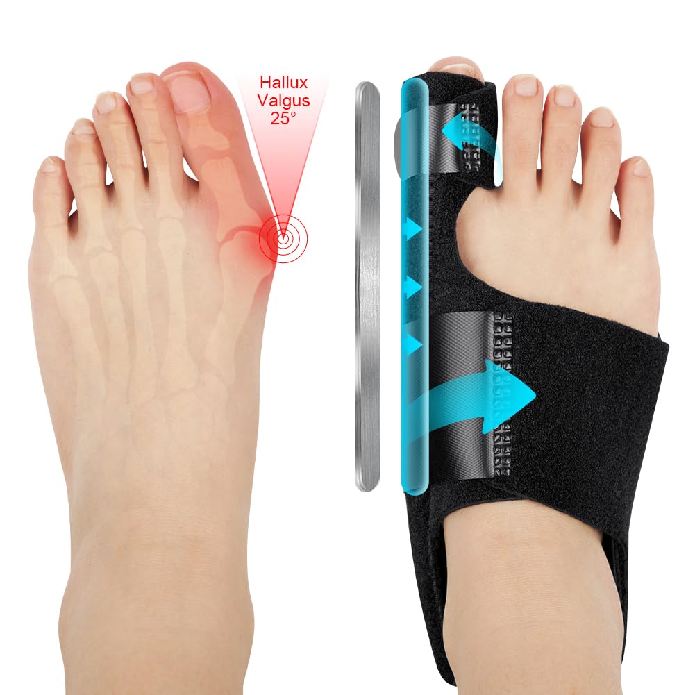 Detalle de ACWOO 4062627 hallux-valgusset met verstelbare spalken en gelteenstrekkers