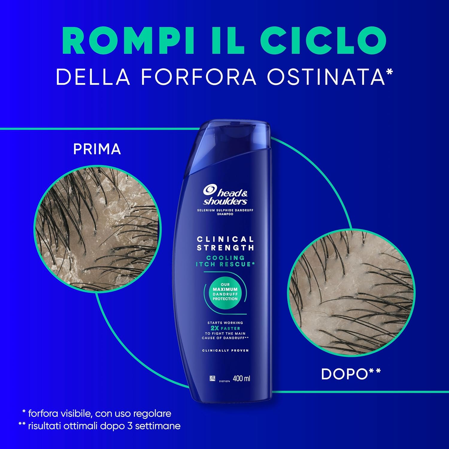 Detalle de Head & Shoulders Clinical Strength Shampoo antiforfora 400 ml