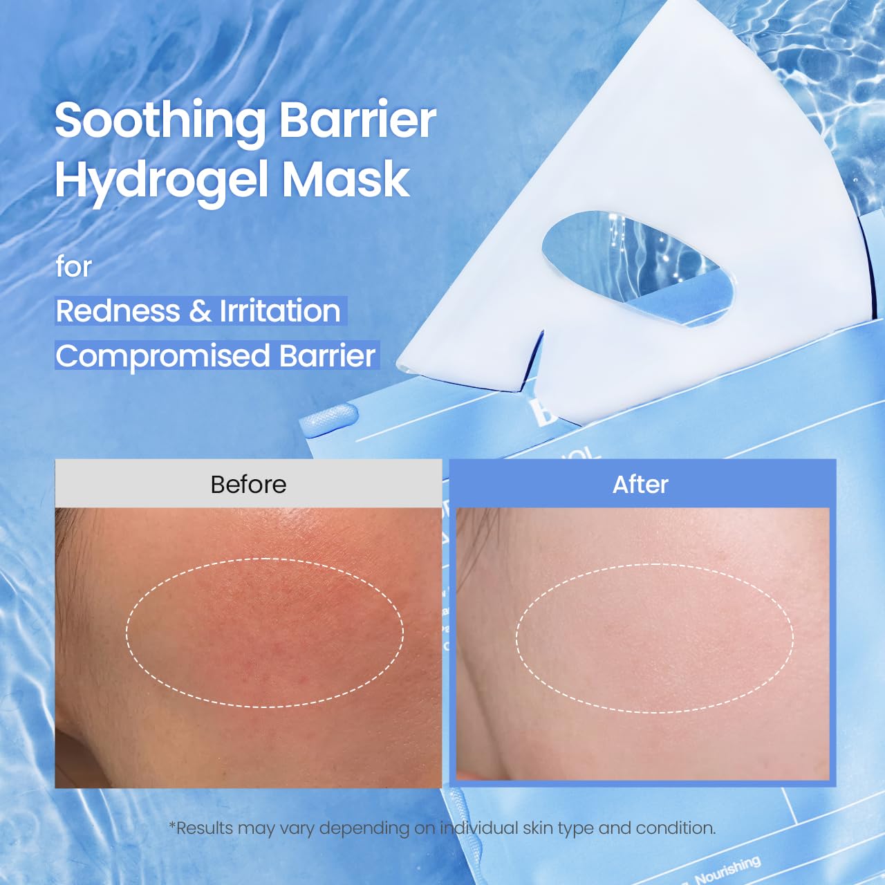 Detalle de BIODANCE Hydro Cera-nol Real Deep Maske – Overnight Hydrogel Maske, beruhigend und feuchtigkeitsspendend (34 g × 4 St.)
