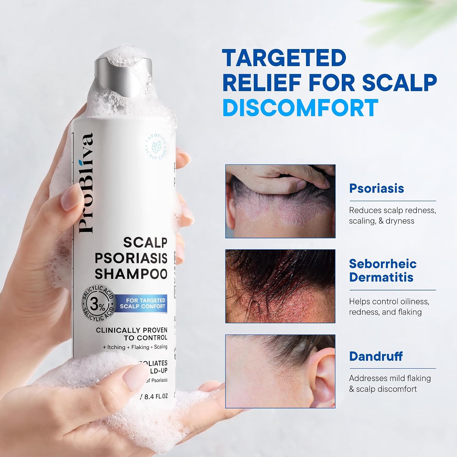 Detalle 1 de ProBliva Psoriasis Shampoo with 3% Salicylic Acid, 8.4 fl oz