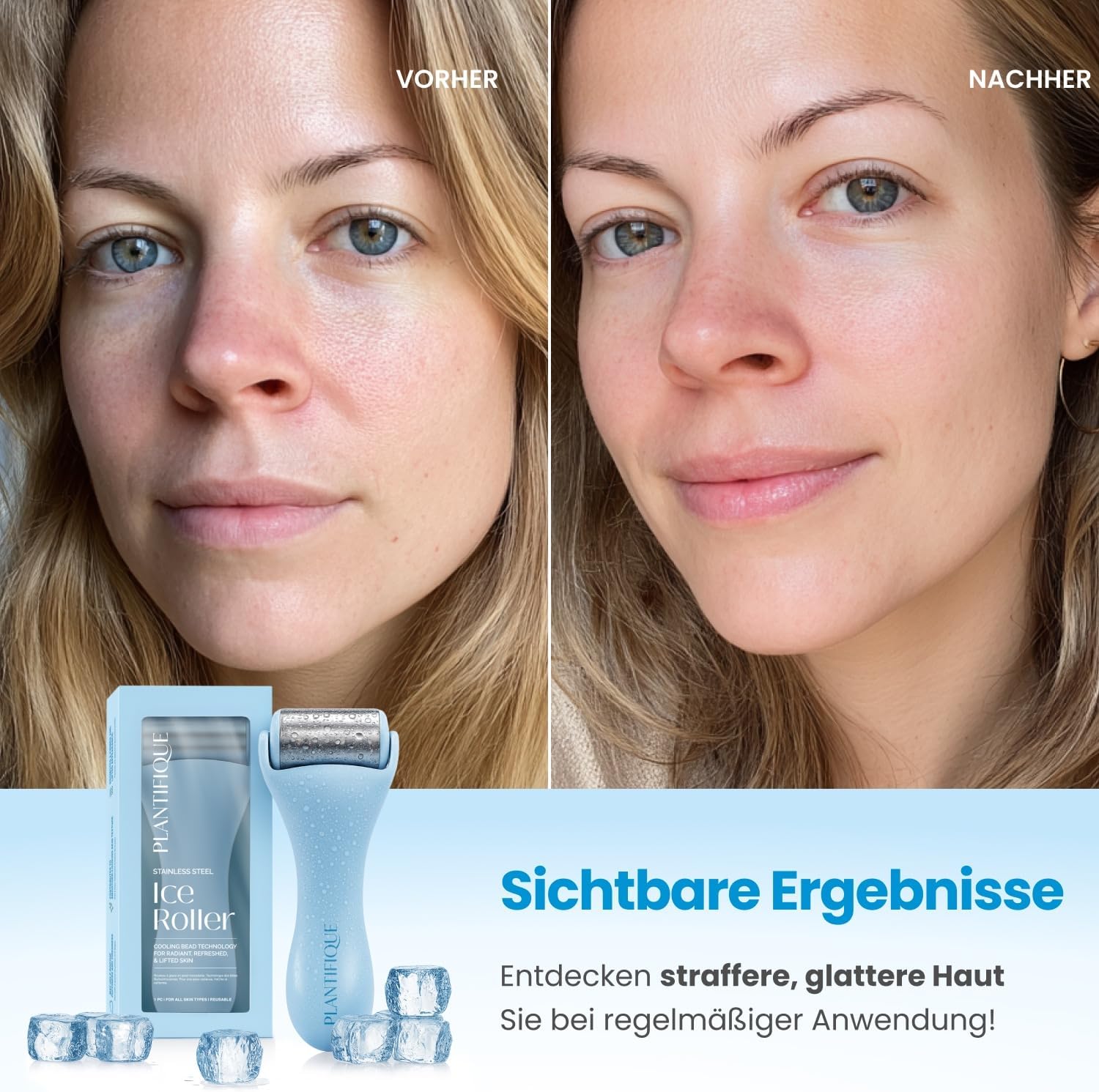 Detalle de PLANTIFIQUE Ice Roller fürs Gesicht – Eisroller zur Gesichtsmassage & Kühlung gegen Schwellungen, Augenringe und Falten