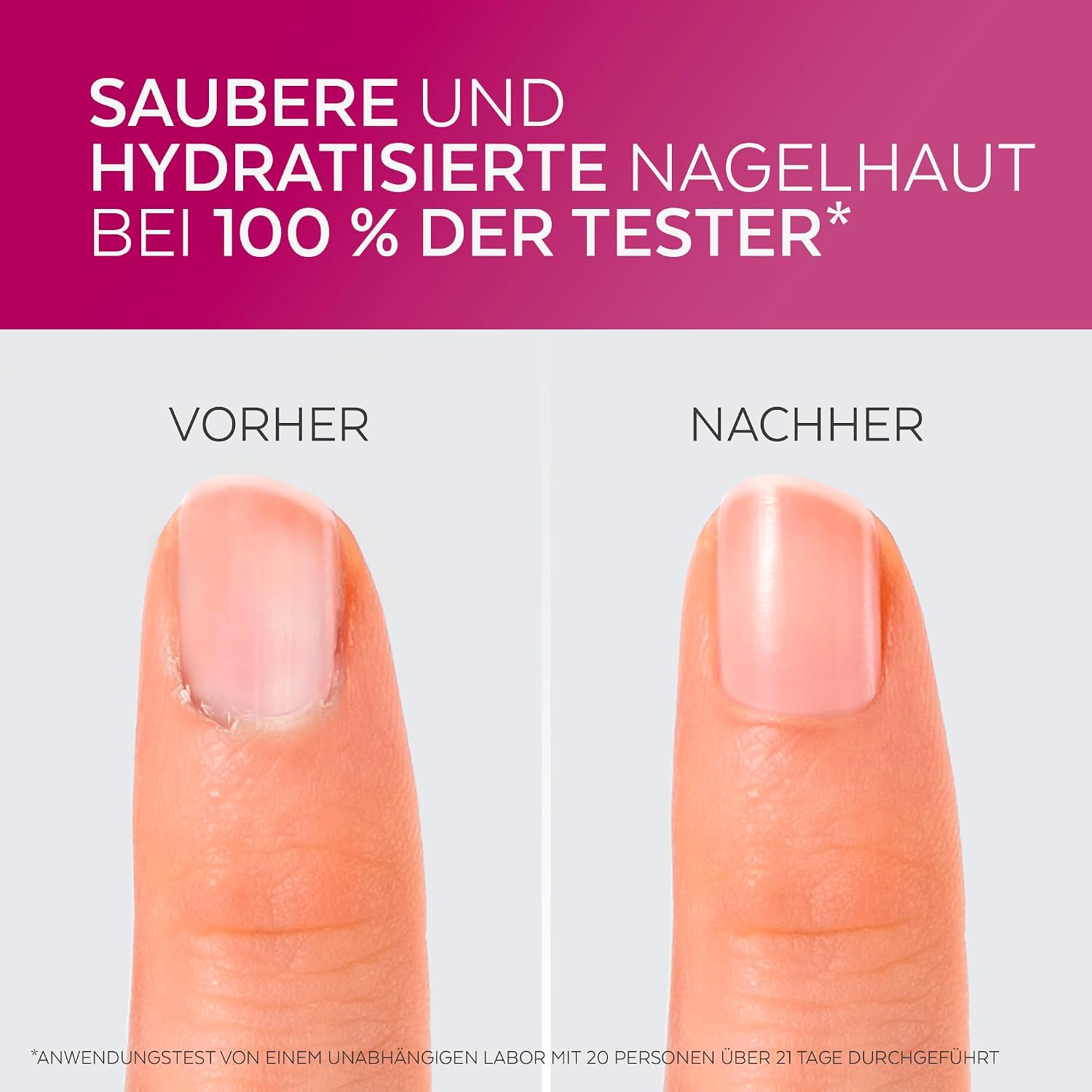 Detalle de PODERM Nagelhautentferner 30 Sekunden 💅