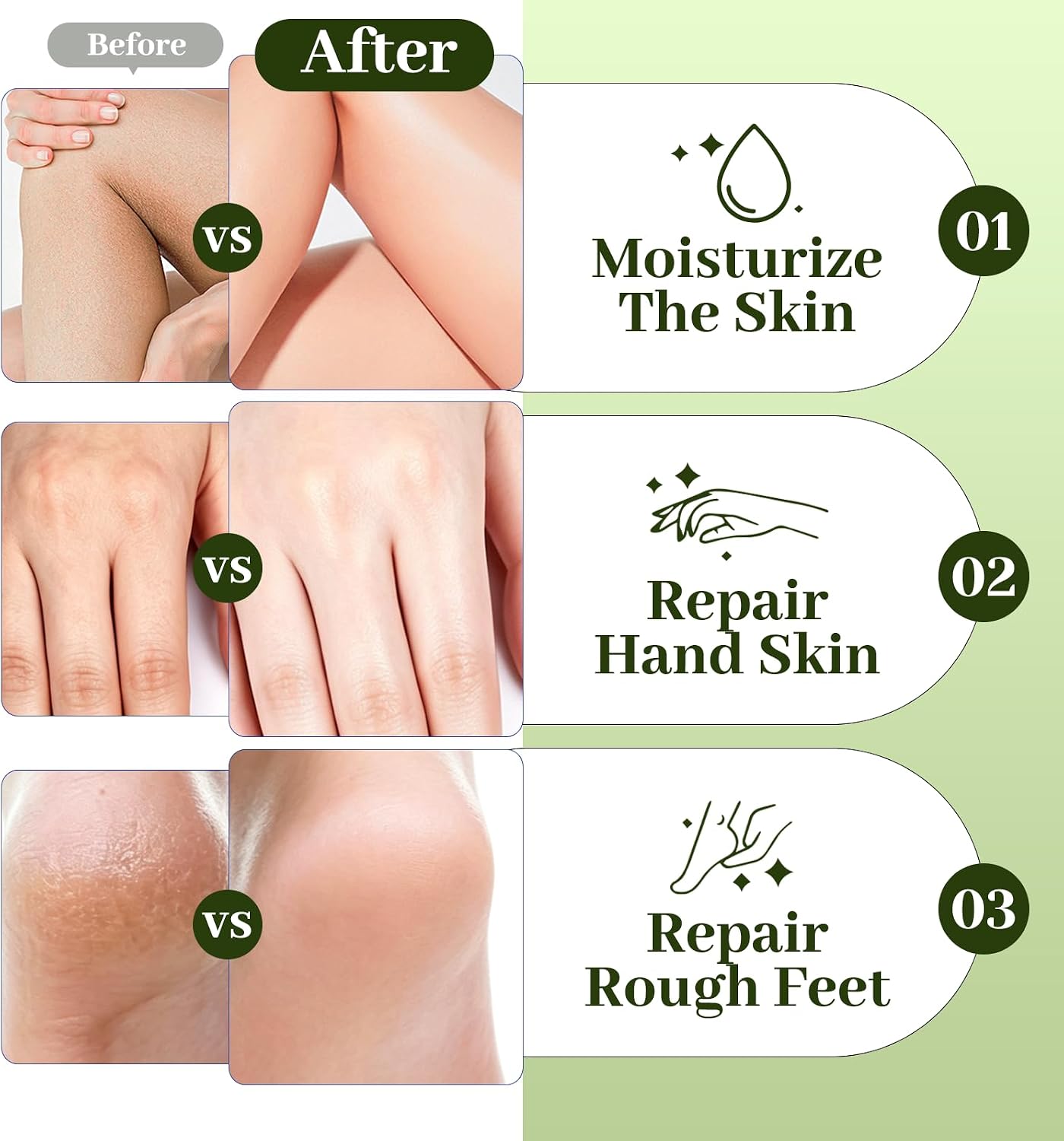 Detalle 2 de Yegfit Urea Foot Cream, 150 g Moisturizer with Shea Butter and Aloe Vera