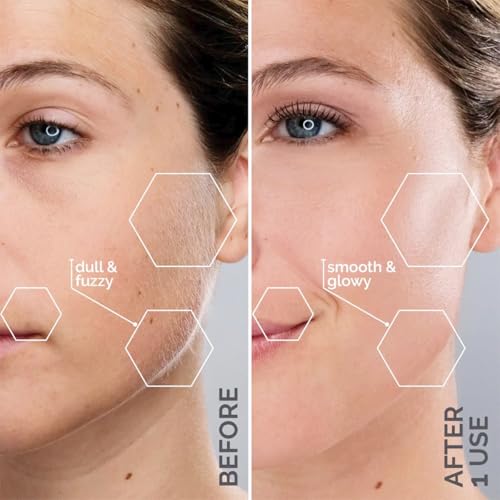 Thumbnail 3 de Michael Todd Beauty Sonicsmooth Dermaplane Razor — 8 Weeks 🪒