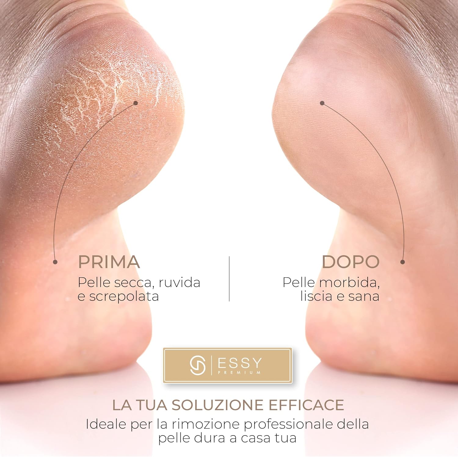 Thumbnail 2 de Essy Pedicure Elettrica Professionale per Piedi con 5 Rulli Sostituibili (Bianco) – Lima per calli e duroni