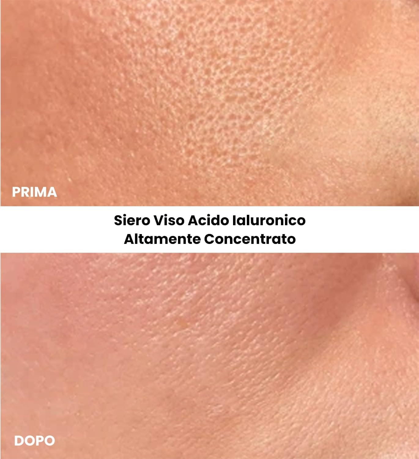 Thumbnail 4 de Siero Antirughe Elasticizzante 1,8% Acido Ialuronico