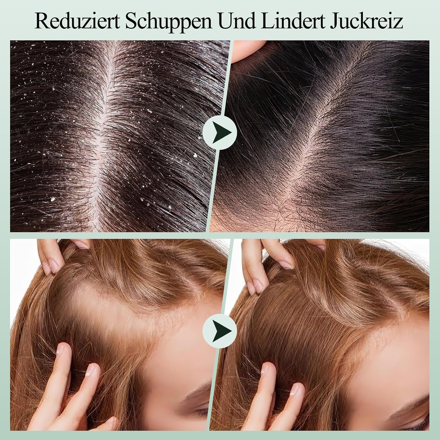 Thumbnail 5 de Kopfhautpeeling Rosmarin 2-in-1 – VOERUY mit Minzöl und Silikon-Massagegerät, 300 g