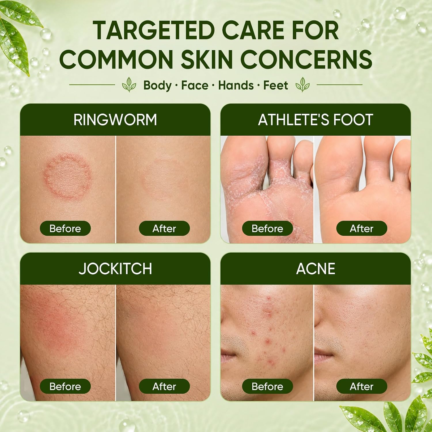 Thumbnail 3 de Tea Tree Soap Bar 3-Pack