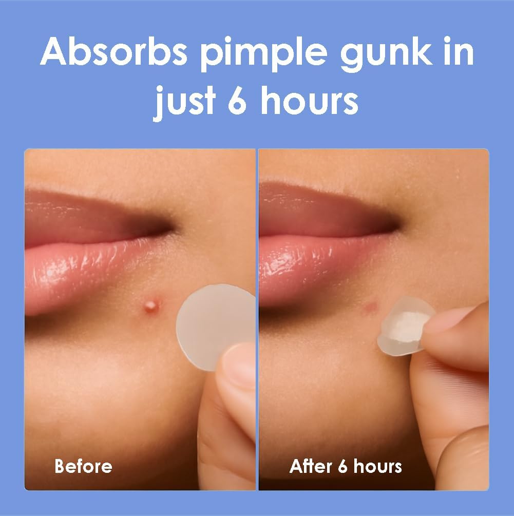 Thumbnail 3 de Pimple Patches for Face 1250-count