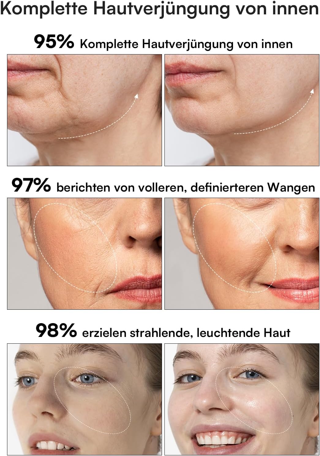 Detalle de INIA Professionelles 3‑in‑1 Anti‑Falten Gerät