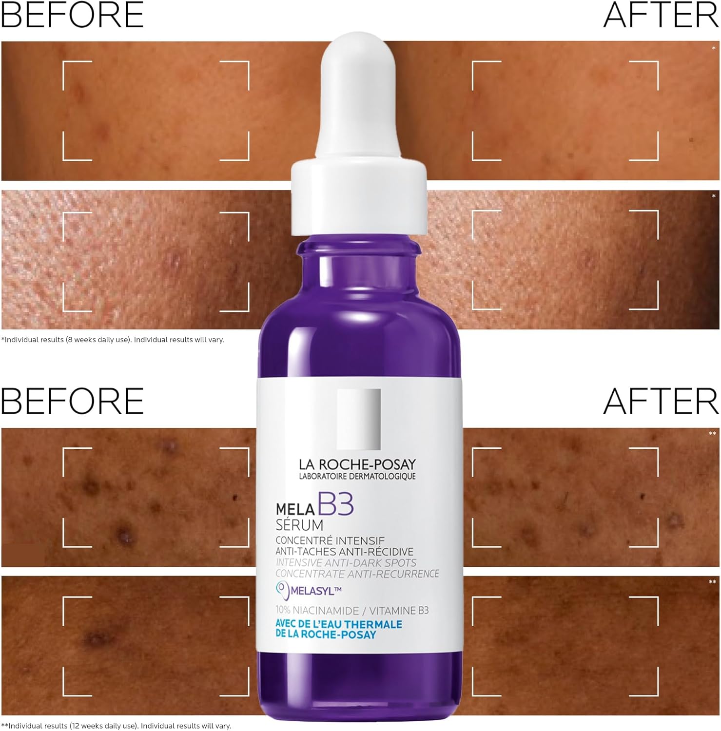 Thumbnail 2 de La Roche-Posay Mela B3 Serum: Intense Anti-Dark Spot Serum for Sensitive Skin